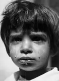 Werner Bischof, Weinendes Mädchen. Im Kinderdorf Hajdúhadház, Ungarn, 1947, Späterer Silbergelatineabzug