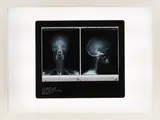 Self-Portrait by Damien Hirst, print (other), sold Feb 2026
