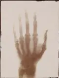 & Others Three Early X-Ray Photographs by Eugène Ducretet, print, offered Nov 2025