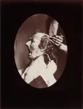 The Mechanism of Human Facial Expression [Fig by G.-B. (Guillaume Benjamin) Duchenne, print, offered Nov 2025