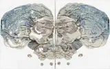 Skull Rorschach #2 by Ben Quilty, 2008, oil on linen, diptych, sold Aug 2018