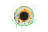 Untitled by Marc Quinn, print, offered Jul 2024