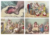 ‘’The Gout’’ by James Gillray, 1799, print (other), sold Oct 2023