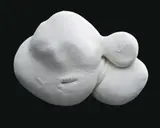 Stem Cell by Patricia Piccinini, 2003, Edition: edition of 10, sold Apr 2014