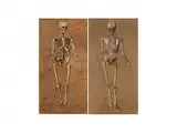 Ansicht Eines Menschlichen Skeletts von Hinten by Monogrammist A. B., watercolor, offered Sep 2015