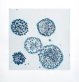 Cluster by Ross Bleckner, 2002, Etching and Aquatint in Colors on Paper, sold Jan 2025