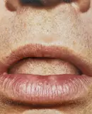 Lips Close-Up by Corinna Holthusen, 2001, Chromogenic Print in Colors on Acrylic, sold Jun 2025