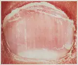 Ongle n° 19 by Patrick Tosani, 1990, Tirage cibachrome, sold Oct 2011