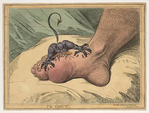 James Gillray, The Gout