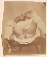 Nadar, Hermaphrodite