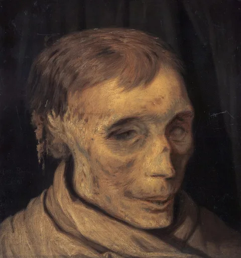 Otto Bache, James Hepburn, 4th Earl of Bothwell, c 1535 - 1578. Third husband of Mary, Queen of Scots (Study of mummified head)