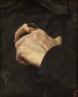 Charles Matet, La main d'Alfred Bruyas
